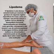  Tratamento de Lipedema - Alívio e Conforto no Rio de Janeiro/RJ