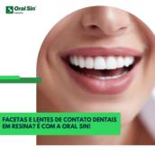 Facetas e Lentes de Contato Dental em Resina em Bauru