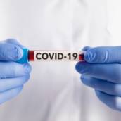 Teste de COVID - 19 
