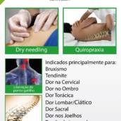Quiropraxia
