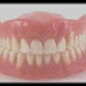 Dentadura - Técnica Moderna com Mais Estética - Macatuba