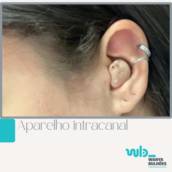 Aparelho intracanal