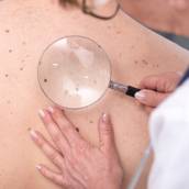 Avaliação Clínica com Ênfase Dermatológica: Saúde da Pele e Bem-Estar em Itatinga - SP