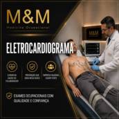 Eletrocardiograma: Avaliação da Saúde Cardiovascular em Itatinga - SP