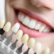 Clareamento Dentário: Sorriso Brilhante e Natural em São Manuel - SP