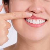Periodontia em Avaré – Saúde da Gengiva com a Ponto Dentes