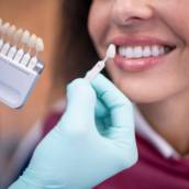 Facetas Estéticas em Avaré – Sorriso Branco, Alinhado e Natural