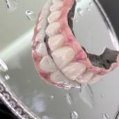 Implante Dentário com Segurança e Estética em Avaré - SP