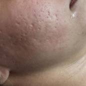 Cuidados com a Pele – Rejuvenescimento e Bem-Estar em Avaré, SP