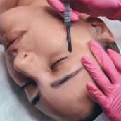 Dermaplaning – Pele Renovada e Suave em Cascavel, PR