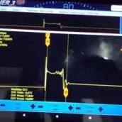 Osciloscópio Diagnóstico Avançado – Precisão e Confiabilidade para Seu Veículo em Dourados, MS