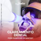 Clareamento Dental em Avaré – Sorriso Branco e Confiante com a Ponto Dentes