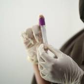 Exames Laboratoriais Precisos | Medicina do Trabalho Caraguatatuba