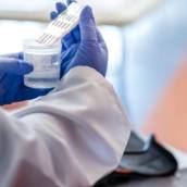 Exame Toxicológico em Santarém/PA – Segurança e Precisão com o Laboratório Primavera