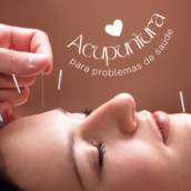  Acupuntura em Americana – Tradição chinesa no alívio de dores e equilíbrio energético