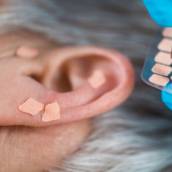 Auriculoterapia em Jundiaí