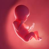 Exame de Sexagem Fetal 