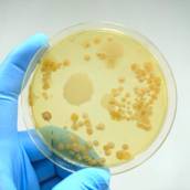 Exames de Microbiologia 