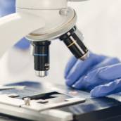 Exames de Parasitologia 