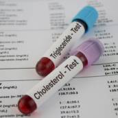 Exames de Bioquímica 