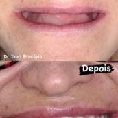 Odontologia em Hortolândia – Odonto Los Angeles