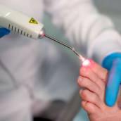 Laserterapia para Fungos