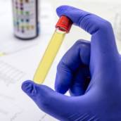 Exames Toxicológicos com Agilidade – Medicina do Trabalho em Caraguatatuba