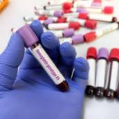 Conserto e Manutenção de Câmaras de Hemoglobina – São Tiago MG