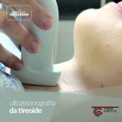 Ultrassom da tireóide