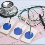 Eletrocardiograma: Avaliação da Saúde Cardiovascular em Pardinho