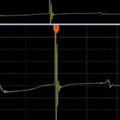 Diagnóstico de Vela e Bobina – Oficina Mecânica em Dourados