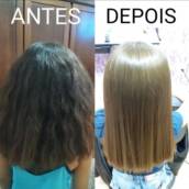 Botox em Avaré