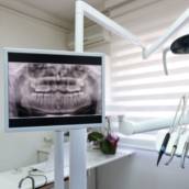 Raio-X Periapical - Diagnóstico Preciso e Confiável em Lençóis Paulista, SP