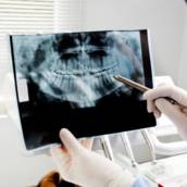 RX Periapical Boca-Toda - Diagnóstico Preciso em Lençóis Paulista, SP