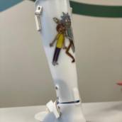 Órtese Suropodálica Articulada Infantil Personalizada - Melhore a Marcha em Ribeirão Preto/SP