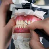 Próteses Removíveis em Lençóis Paulista – Conforto e Qualidade de Vida