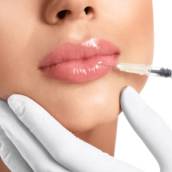 Preenchimento Labial em Teresina/PI