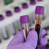 Teste de Covid Rápido e Confiável em Santarém – Laboratório Primavera