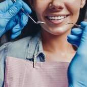 Lentes de Contato Dental: Estética e Naturalidade para o Seu Sorriso em Uberlândia/MG