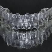 Ortodontia - Alinhadores: O Sorriso Perfeito em Uberlândia/MG