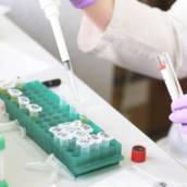 Exames de sangue Birigui