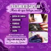 Tratamento para alopecia areata, androgenética e queda capilar em São Paulo