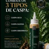 Tratamento para Caspa Vitality em São Paulo