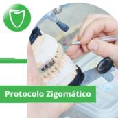 Protocolo Zigomático em Itapetininga 