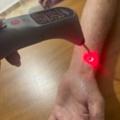 Tratamento a Laser em Araruama, RJ