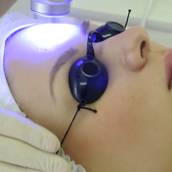 Laserterapia