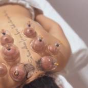 Massagem com ventosa