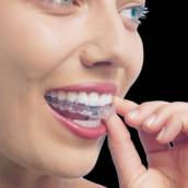 Invisalign
