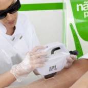 Fotodepilação