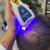 Tratamento Capilar a Laser 